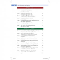 KNEE ARTHROSCOPY: A CASE REPOSITORY book by Sachin Tapasvi, Anshu Shekhar - Additional Image 6
