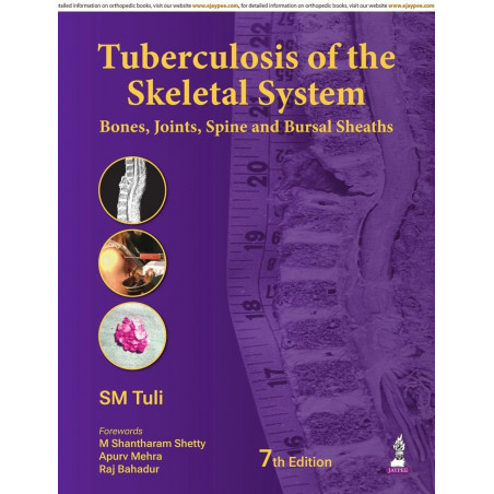 Tuberculosis of the Skeletal System (Bones, Joints, Spine and Bursal Sheaths) book by SM Tuli