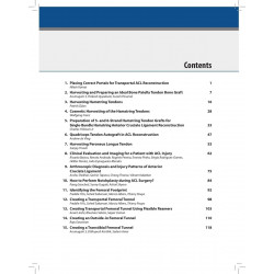 Techniques in ACL Surgery book by Sachin Ramchandra Tapasvi, Shantanu Patil - Additional Image 5