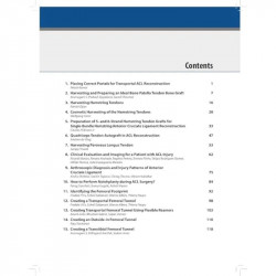 Techniques in ACL Surgery book by Sachin Ramchandra Tapasvi, Shantanu Patil - Additional Image 6