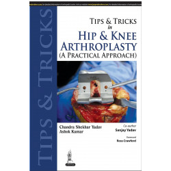 Tips and Tricks in Hip and Knee Arthroplasty: (A Practical Approach) (Tips & Tricks) book by Chandra Shekhar Yadav, Ashok Ku…