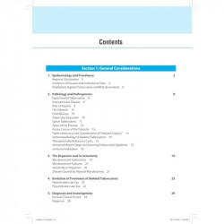 Tuberculosis of the Skeletal System (Bones, Joints, Spine and Bursal Sheaths) book by SM Tuli - Additional Image 5