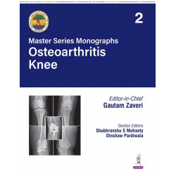 BOS Master Series Monographs (Volume 2) Osteoarthritis Knee book by Gautam Zaveri, Shubhranshu S Mohanty