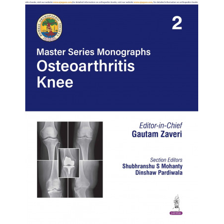 BOS Master Series Monographs (Volume 2) Osteoarthritis Knee book by Gautam Zaveri, Shubhranshu S Mohanty