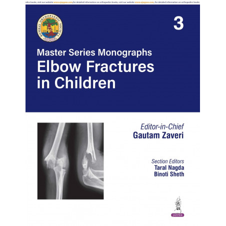 BOS Master Series Monographs (Volume 3) Elbow Fractures in Children book by Gautam Zaveri, Taral Nagda