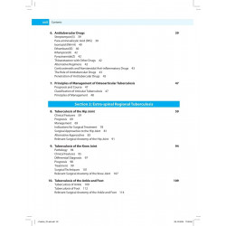 Tuberculosis of the Skeletal System (Bones, Joints, Spine and Bursal Sheaths) book by SM Tuli - Additional Image 6