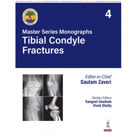 BOS Master Series Monographs (Volume 4) Tibial Condyle Fractures book by Gautam Zaveri, Sangeet Gawhale