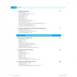 Tuberculosis of the Skeletal System (Bones, Joints, Spine and Bursal Sheaths) book by SM Tuli - Additional Image 7