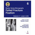 BOS Master Series Monographs (Volume 6) Failed Fracture Fixation Volume 2: Lower Limb book by Gautam Zaveri, Harshad Argekar
