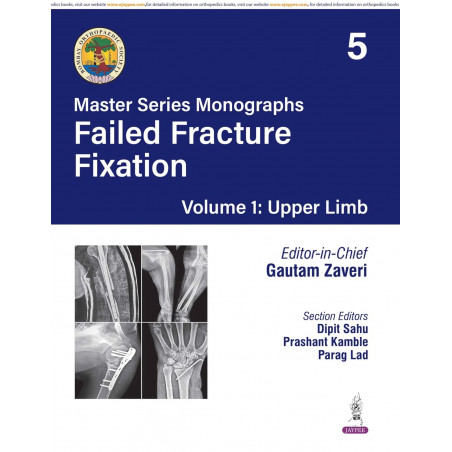 BOS Master Series Monographs (Volume 5) Failed Fracture Fixation Volume 1: Upper Limb book by Gautam Zaveri, Dipit Sahu