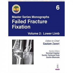 BOS Master Series Monographs (Volume 6) Failed Fracture Fixation Volume 2: Lower Limb book by Gautam Zaveri, Harshad Argekar - B