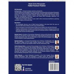 BOS Master Series Monographs (Volume 6) Failed Fracture Fixation Volume 2: Lower Limb book by Gautam Zaveri, Harshad Argekar - A