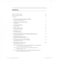BOS Master Series Monographs (Volume 4) Tibial Condyle Fractures book by Gautam Zaveri, Sangeet Gawhale - Additional Image 6