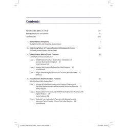 BOS Master Series Monographs (Volume 6) Failed Fracture Fixation Volume 2: Lower Limb book by Gautam Zaveri, Harshad Argekar - A