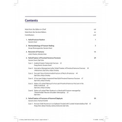 BOS Master Series Monographs (Volume 5) Failed Fracture Fixation Volume 1: Upper Limb book by Gautam Zaveri, Dipit Sahu - Additi