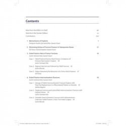 BOS Master Series Monographs (Volume 6) Failed Fracture Fixation Volume 2: Lower Limb book by Gautam Zaveri, Harshad Argekar - A