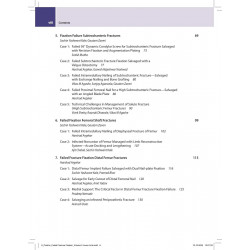 BOS Master Series Monographs (Volume 6) Failed Fracture Fixation Volume 2: Lower Limb book by Gautam Zaveri, Harshad Argekar - A