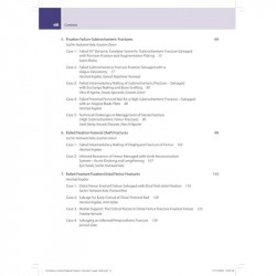 BOS Master Series Monographs (Volume 6) Failed Fracture Fixation Volume 2: Lower Limb book by Gautam Zaveri, Harshad Argekar - A