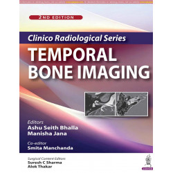 Clinico Radiological Series: Temporal Bone Imaging book by Ashu Seith Bhalla, Manisha Jana