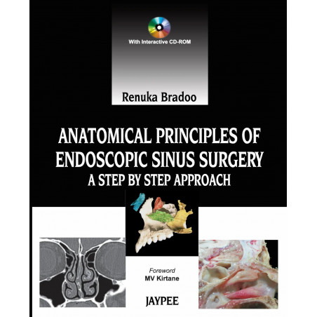 ANATOMICAL PRINCIPLES OF ENDOSCOPIC SINUS SURGERY: A STEP BY STEP APPROACH WITH INTERACTIVE CD-ROM book by Bradoo