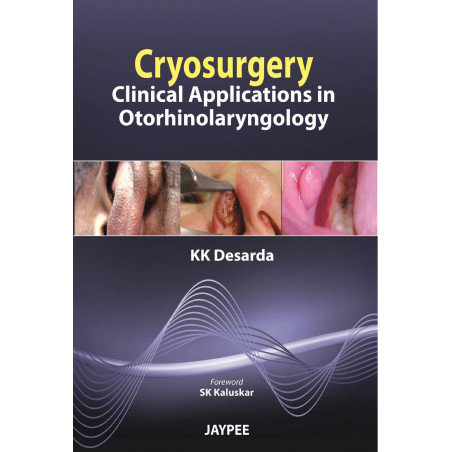 Cryosurgery: Clinical Applications in Otorhinolaryngology book by Desarda