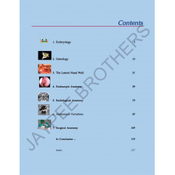 ANATOMICAL PRINCIPLES OF ENDOSCOPIC SINUS SURGERY: A STEP BY STEP APPROACH WITH INTERACTIVE CD-ROM book by Bradoo - Additional I