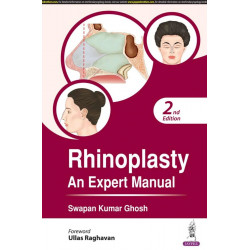 RHINOPLASTY AN EXPERT MANUAL book by Swapan Kumar Ghosh