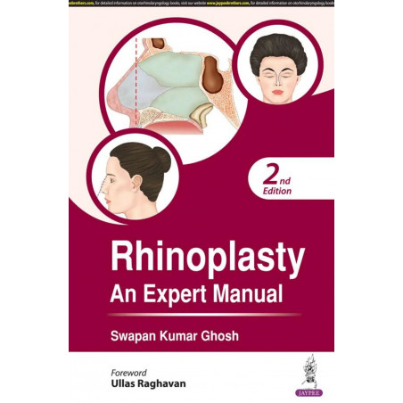 RHINOPLASTY AN EXPERT MANUAL book by Swapan Kumar Ghosh