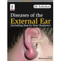 DISEASES OF THE EXTERNAL EAR (INCLUDING STEP-BY-STEP OTOPLASTY) book by Kaluskar Sk