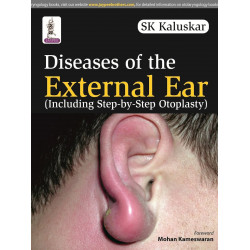 DISEASES OF THE EXTERNAL EAR (INCLUDING STEP-BY-STEP OTOPLASTY) book by Kaluskar Sk