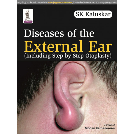 DISEASES OF THE EXTERNAL EAR (INCLUDING STEP-BY-STEP OTOPLASTY) book by Kaluskar Sk