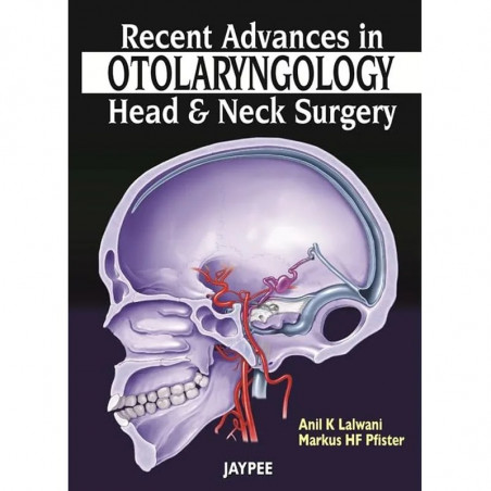 Recent Advances in Otolaryngology: Head & Neck surgery (POD) book by Lalwani
