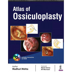 ATLAS OF OSSICULOPLASTY book by Madhuri Mehta