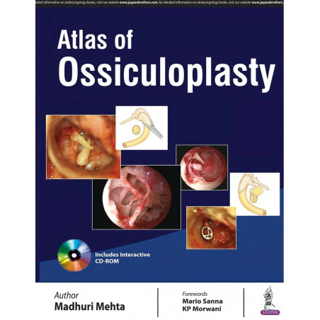 ATLAS OF OSSICULOPLASTY book by Madhuri Mehta