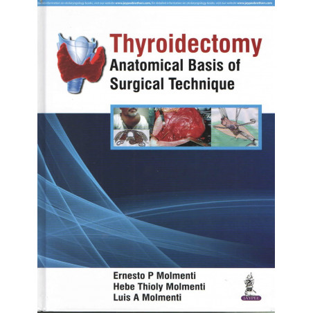 THYROIDECTOMY ANATOMICAL BASIS OF SURGICAL TECHNIQUE book by Ernesto P Molmenti, Hebe Thioly Molmenti