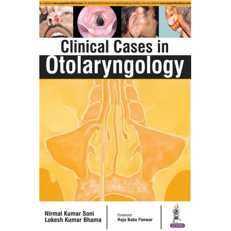 Clinical Cases in Otolaryngology book by Soni Nirmal Kumar