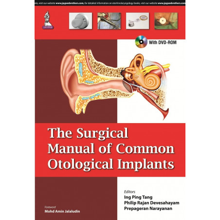 THE SURGICAL MANUAL OF COMMON OTOLOGICAL IMPLANTS WITH DVD-ROM book by Tang Ing Ping