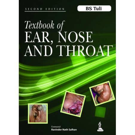 Textbook of Ear, Nose and Throat (POD) book by Tuli. B.S