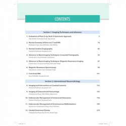 AIIMS-MAMC-PGI Imaging Series Diagnostic Radiology: Neuroradiology Including Head and Neck Imaging book by Paramjeet Singh,… - A