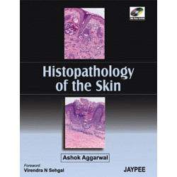 Histopathology of the Skin with CD-ROM (POD) book by Aggarwal