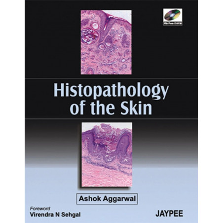 Histopathology of the Skin with CD-ROM (POD) book by Aggarwal