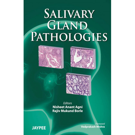 SALIVARY GLAND PATHOLOGIES book by Borle Agni Nisheet Anant