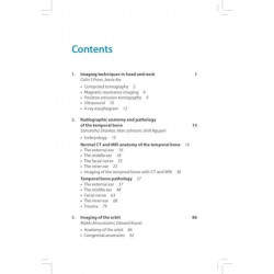 Introductory Head and Neck Imaging book by Yu Eugene - Additional Image 4