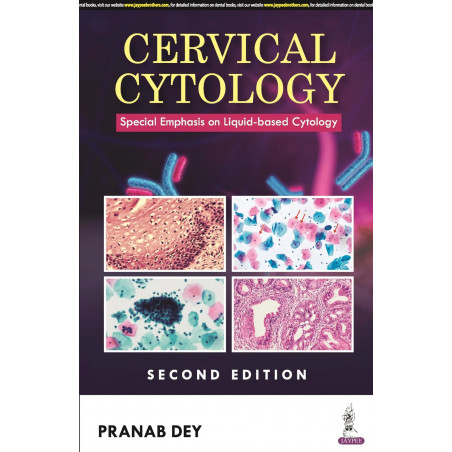 CERVICAL CYTOLOGY: SPECIAL EMPHASIS ON LIQUID-BASED CYTOLOGY book by Pranab Dey