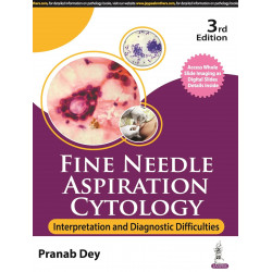 FINE NEEDLE ASPIRATION CYTOLOGY: INTERPRETATION AND DIAGNOSTIC DIFFICULTIES book by "Pranab Dey "