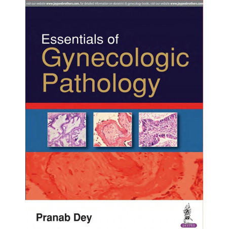 ESSENTIALS OF GYNECOLOGIC PATHOLOGY book by Pranab Dey