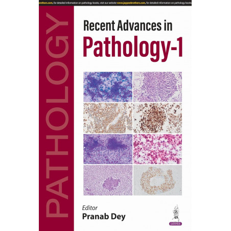 RECENT ADVANCES IN PATHOLOGY-1 book by Pranab Dey