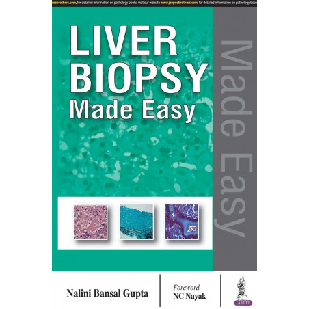 Liver Biopsy Made Easy book by Nalini Bansal Gupta