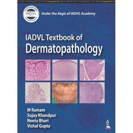 IADVL TEXTBOOK OF DERMATOPATHOLOGY book by M Ramam