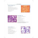 Atlas of Hematology (POD) book by Saxena - Additional Image 4